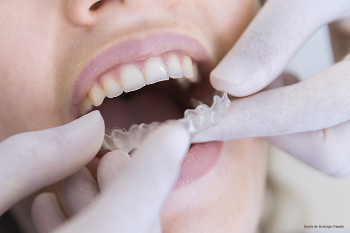 Ortodoncia para adultos invisalign