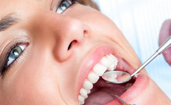 Limpieza dental profunda