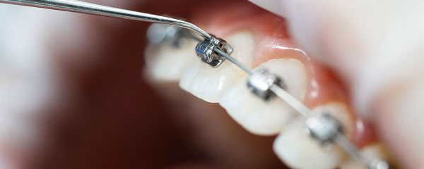 Especialista en ortodoncia en fraga