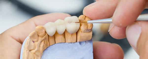 Mejores protesis dentales