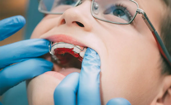 Ortodoncia interceptiva