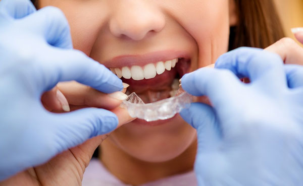 Ortodoncia invisible fraga