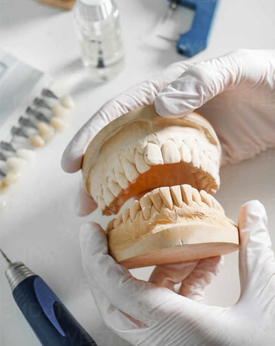 Protesis dental fraga