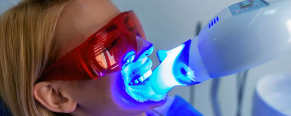 Clinica de blanqueamiento dental en fraga