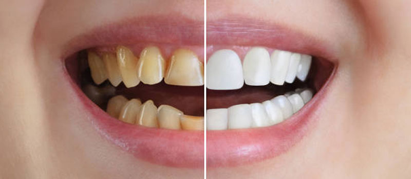 Est&eacute;tica dental