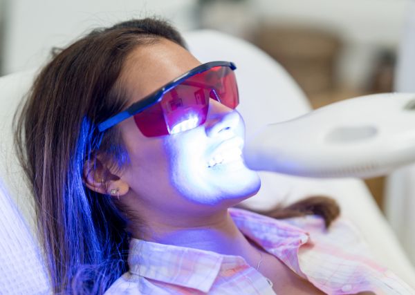 Blanqueamiento Dental LED