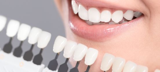 Blanqueamiento dental